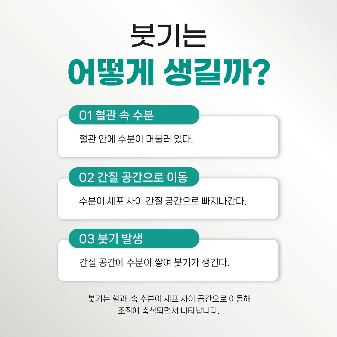 부종이 생기는 수분대사 원리 인포그래픽
