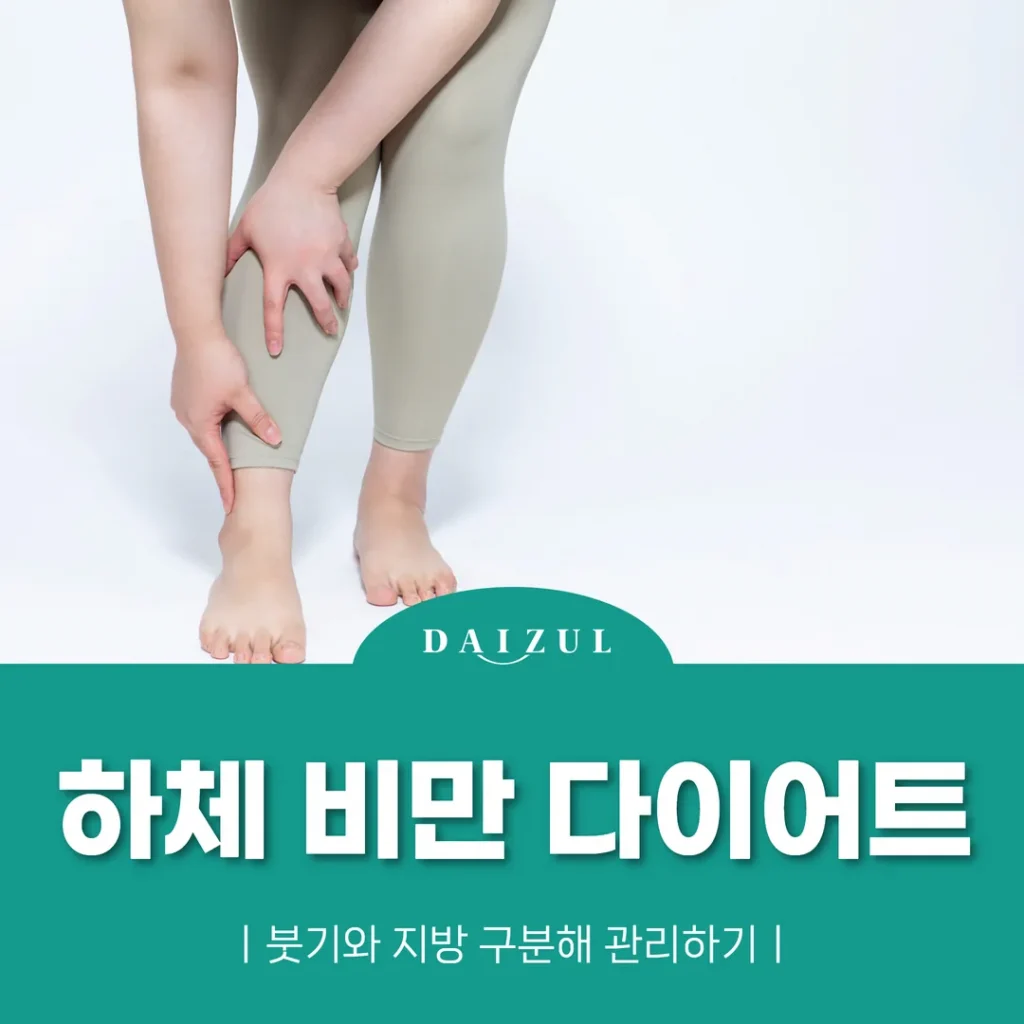 하체 비만 다이어트, 붓기와 지방 구분해 관리하기