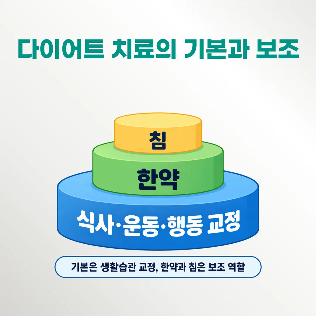 다이어트 한방 치료에서 생활습관 교정과 한약, 침의 무게 차이를 나타낸 층 구조도